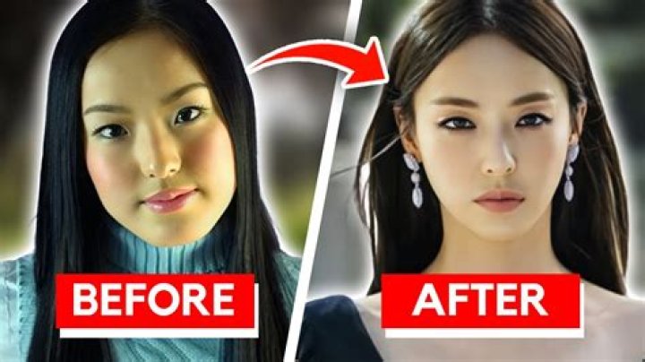 Korean Actors: Surgery Before And After – The Transformation Journey