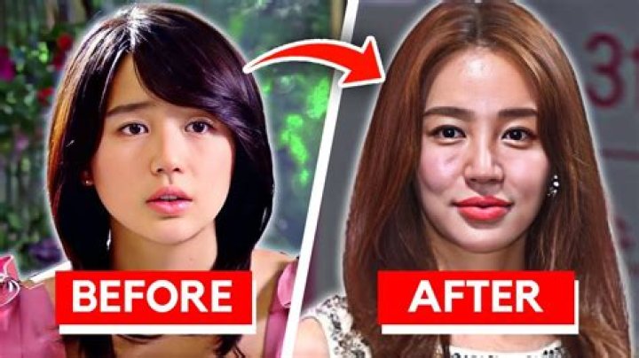 Korean Actresses Who Have Embraced Plastic Surgery: A Closer Look
