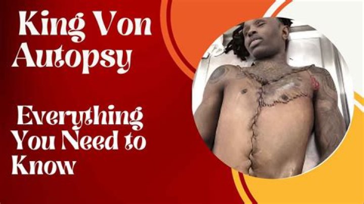 The Shocking Truth: Autopsy Photos Of King Von Revealed